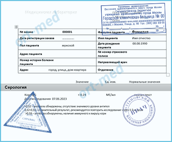 Купить тест на антитела к вирусу кори в Москве Заказать тест на антитела к вирусу кори — Москва